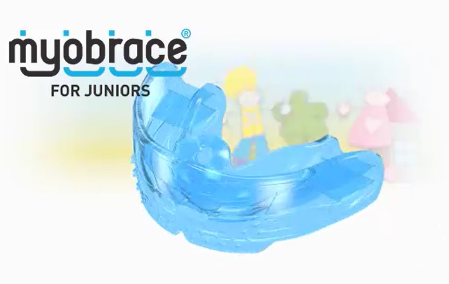 マイオブレース